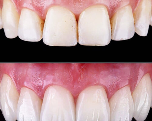 estetica dentale